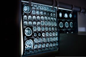 Read more about the article Patient Safety Laws Are Changing, and So Are Malpractice Claims