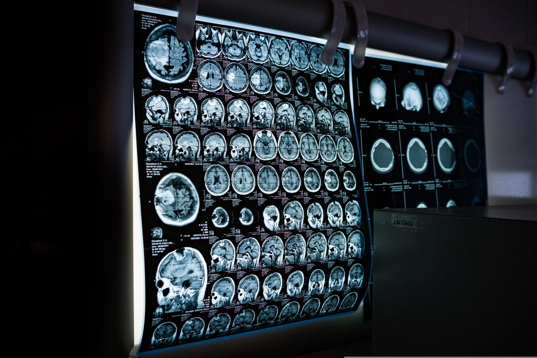 Read more about the article Patient Safety Laws Are Changing, and So Are Malpractice Claims